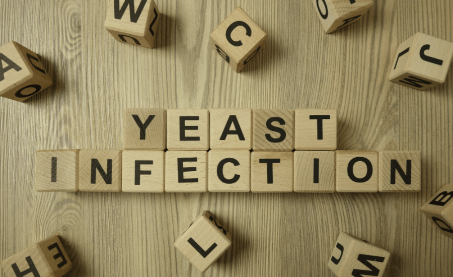 Yeast Allergy Guide