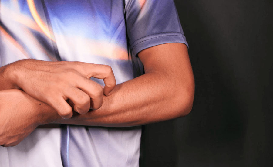 A man scratching his wrist